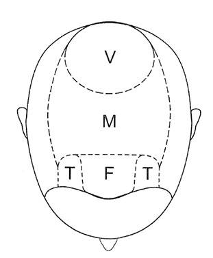 scalp areas