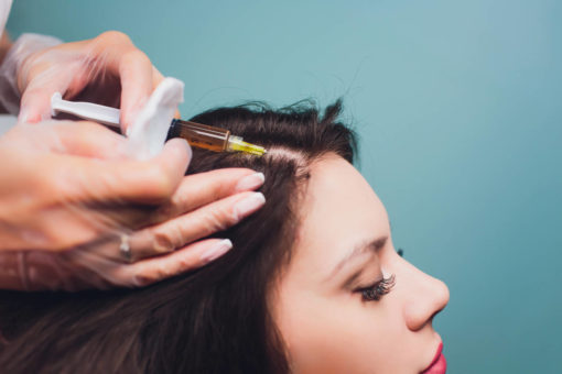 PRP scalp treatment