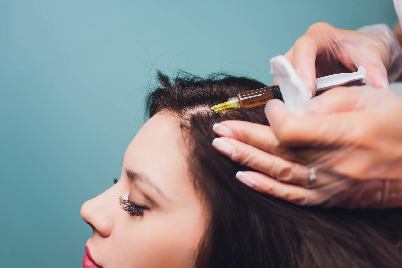 PRP Hair Loss Treatment for Women | Melbourne, FL | Brevard County