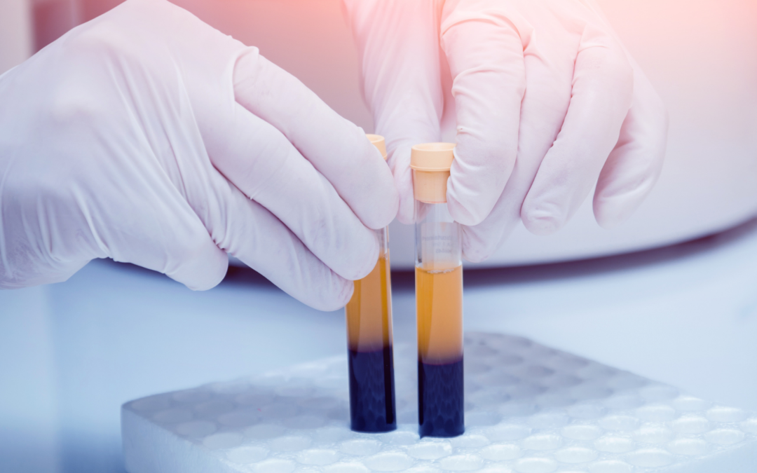 What is Platelet-Rich Plasma (PRP)?