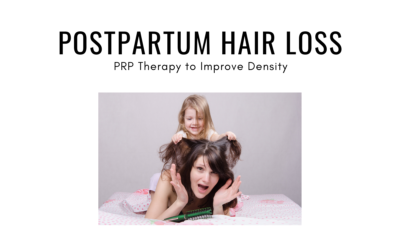 Postpartum Hair Loss: How Can PRP Therapy Improve My Density?