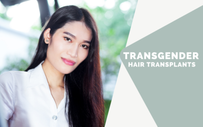 Transgender Hair Transplants: How Much Can They Help Transitioning?