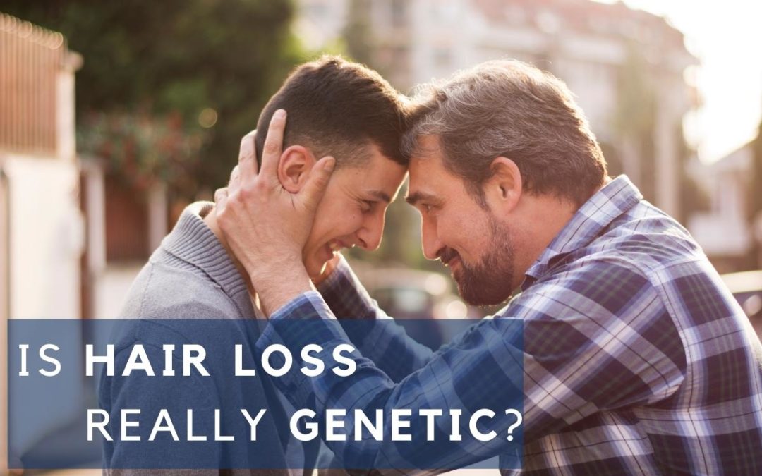 Is Hair Loss Really Genetic? Addressing the Myths