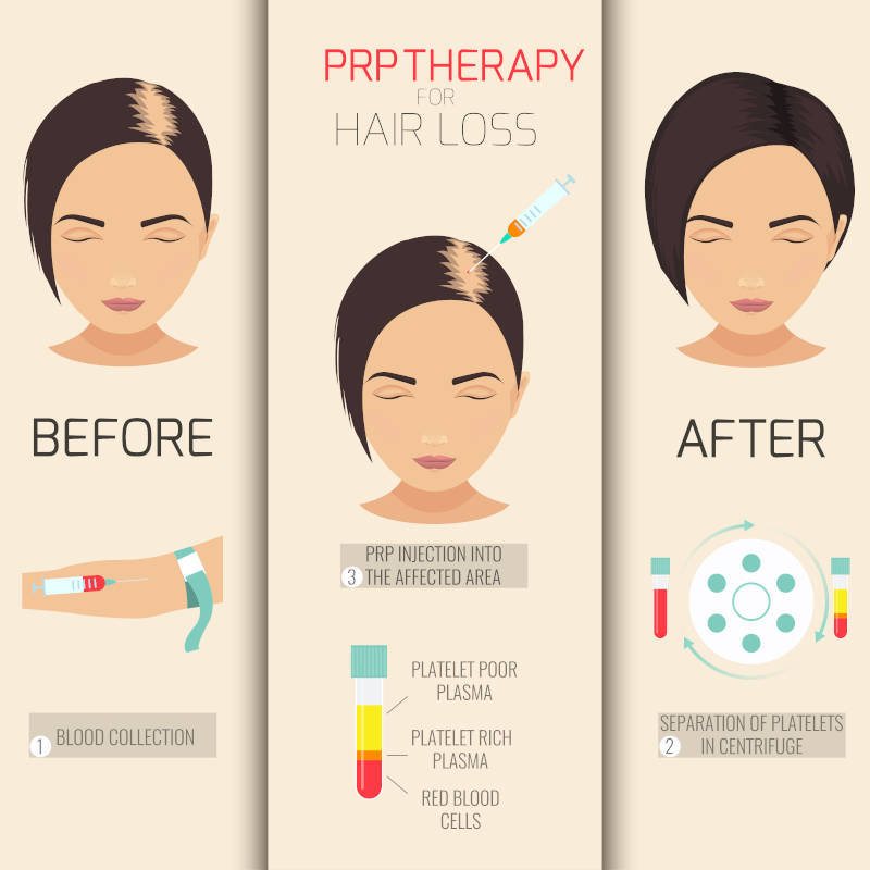 Hair growth diagram