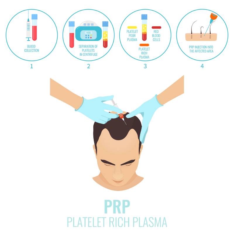 Platelet Rich Plasma Diagram
