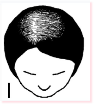 Image for choice number 6