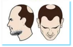 Image for choice number 2