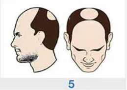 Image for choice number 5