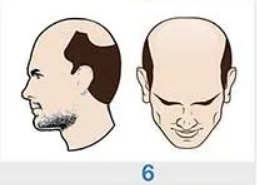 Image for choice number 6