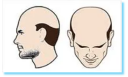 Image for choice number 5