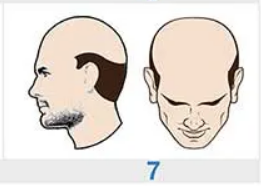 Image for choice number 7