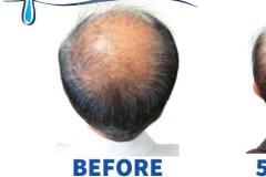 50 Y Male, FUT