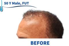 50 Y Male, FUT