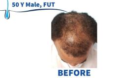 50 Y Male, FUT