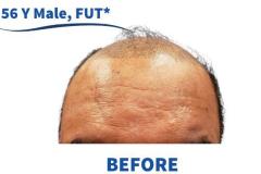 56 Y Male, FUT